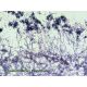 Muestras Bresser para Microscopios - 50 Preparados