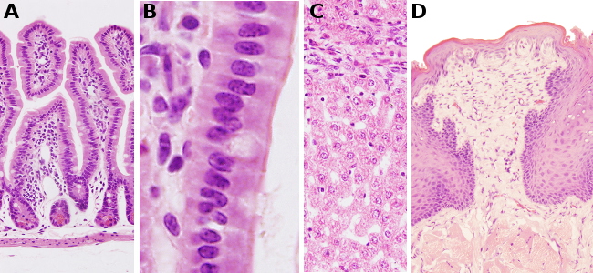 Protocolos ematoxeos